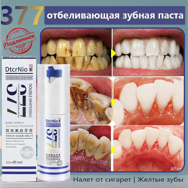 Whitening Toothpaste (120g): Removes Stains & Tartar, Improves Oral Hygiene