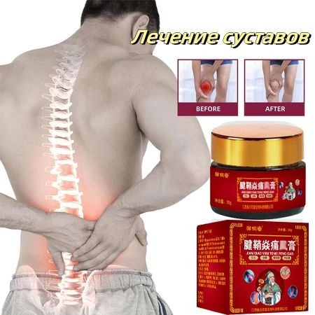 Herbal Gout Cream: Joint & Muscle Pain Relief for Arthritis & Spondylosis