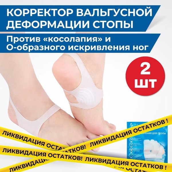 O-Leg Corrector Brace (2-Pack)