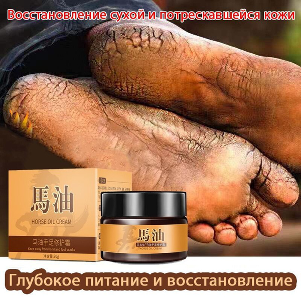 Cracked Heel Repair Cream: Traditional Chinese Foot Cream (30g)