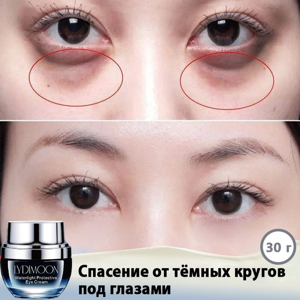 Eye Cream for Dark Circles, Puffiness & Wrinkles - 30ml