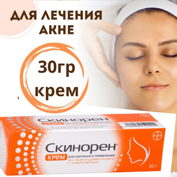 Skinoren 20% Cream (30g Tube)
