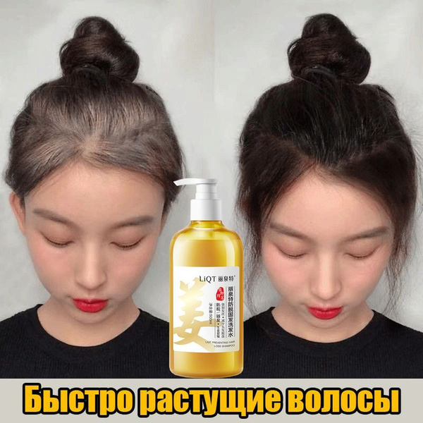 Ginger Shampoo for Hair Growth & Thickness: Prevents Breakage & Hair Loss (500ml)