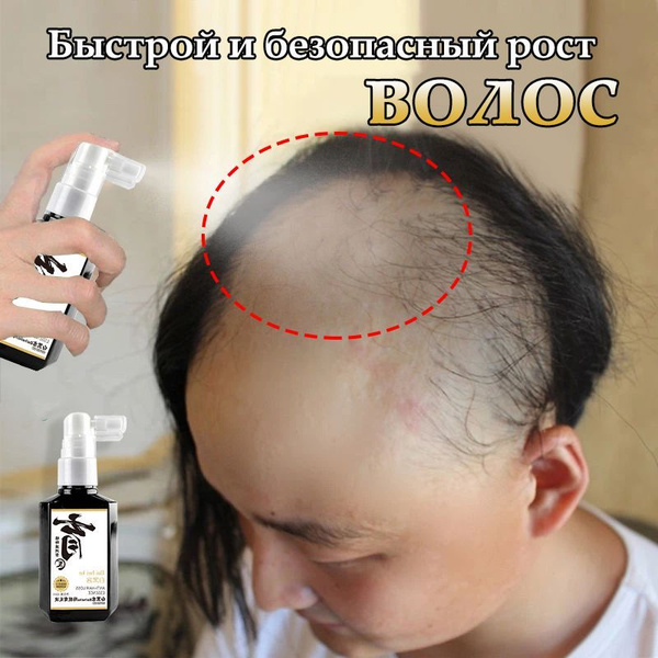 Hair Growth Spray: Thickening, Anti-Hair Loss (60ml) - Niacinamide Formula