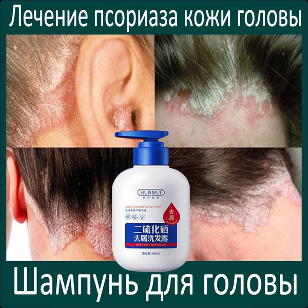 300ml Hair Shampoo
