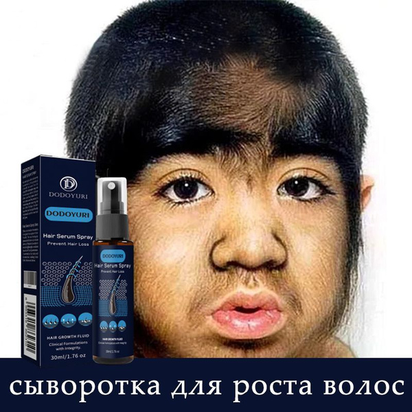 Hair Growth Spray 30ml: Powerful Formula for Hair Loss & Repair