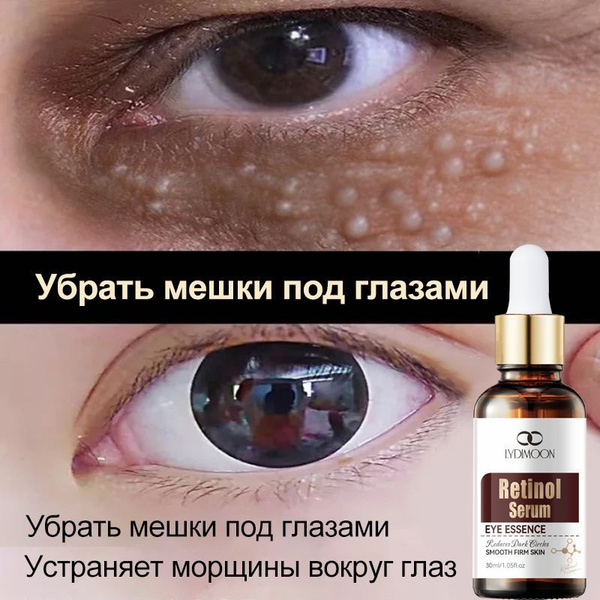 Retinol Eye Cream: Anti-Aging Lift, Reduces Wrinkles, Puffiness & Dark Circles (30ml)