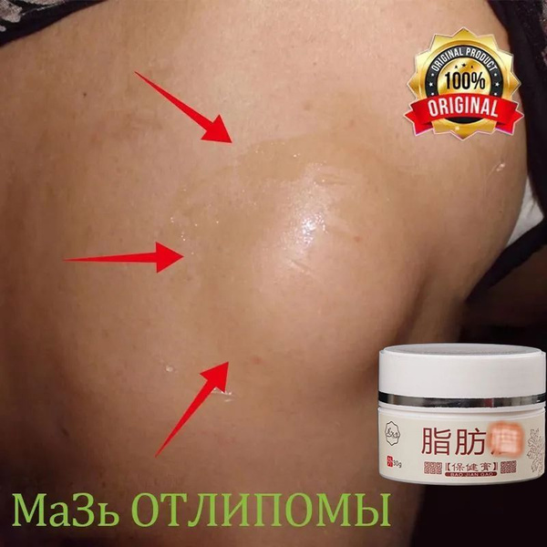 Lipoma Removal Cream: 30g, Effective Fibroma & Lipoma Treatment, Safe & Side Effect Free