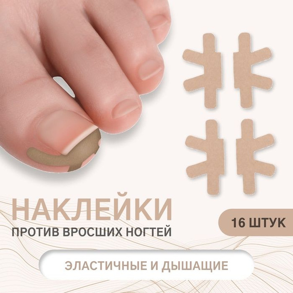 Ingrown Toenail Stickers (16 Count, Beige)