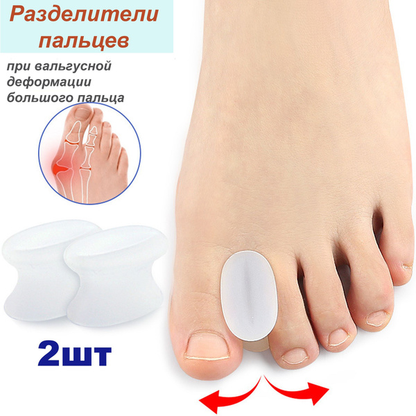 Orthotic Toe Separators