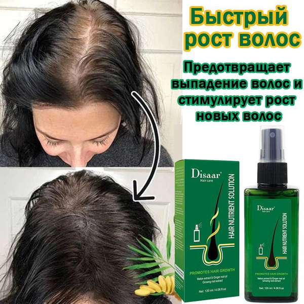 Hair Growth Spray 120ml: Vitamin-Infused Serum for Thickening & Preventing Hair Loss