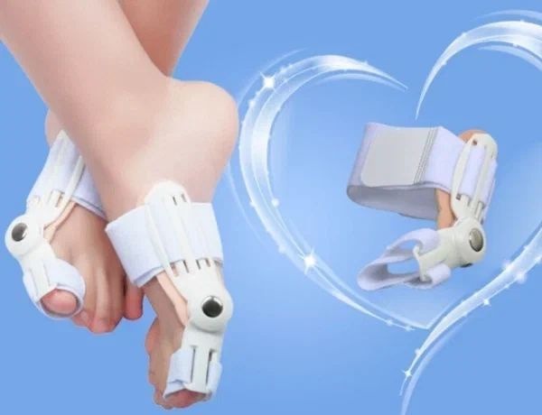 Bunion Corrector: Physiotherapy Support