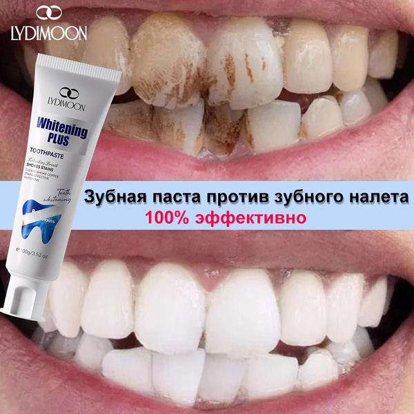 Fluoride-Free Whitening Toothpaste: Sensitive Teeth & Stain Removal (100g)