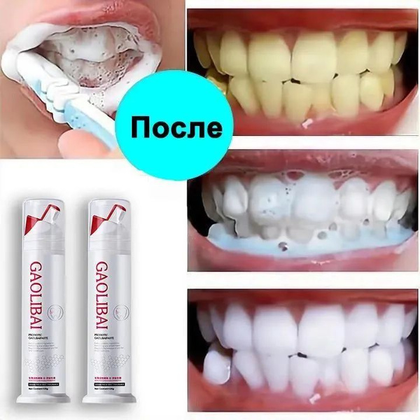 Professional Whitening Toothpaste with Probiotics: 120g, Gentle Whitening, Anti-Cavity & Tartar Control, Gum Repair