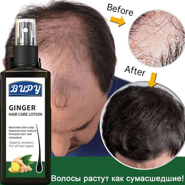 Hair Growth Serum with Vitamins & Ginger - Stop Hair Loss & Grow Faster (120ml)
