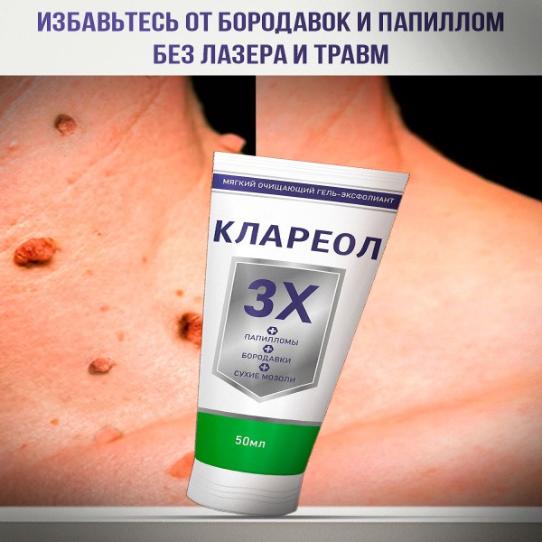 Clareal 50ml: Wart, Papilloma & Callus Removal