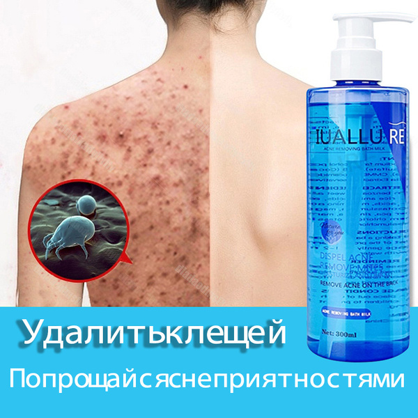 Acne Body Wash: Antibacterial Gel for Clear Skin (300ml)