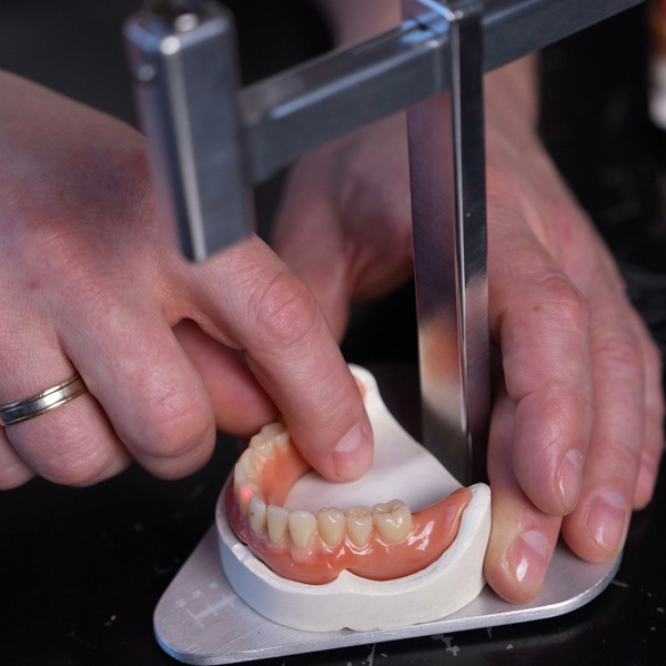 Laser Teeth Straightening: Guide & Treatment