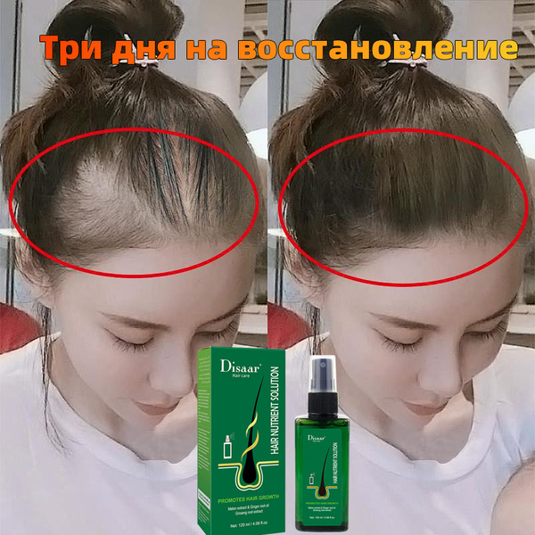 Hair Growth Activator: Thicker, Stronger Hair for Men & Women (120ml)