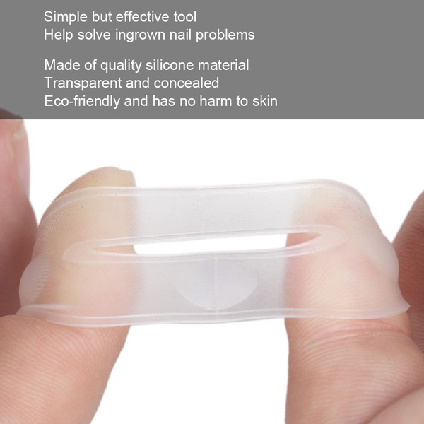 Ingrown Toenail Correction