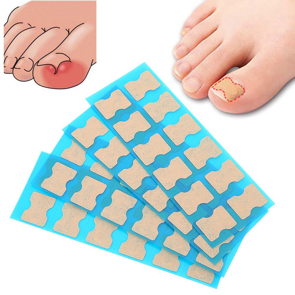 Self-Adhesive Orthotic Nail Stickers