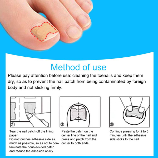 Self-Adhesive Orthotic Nail Stickers