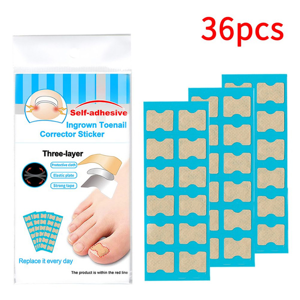 Ingrown Toenail Correction Stickers