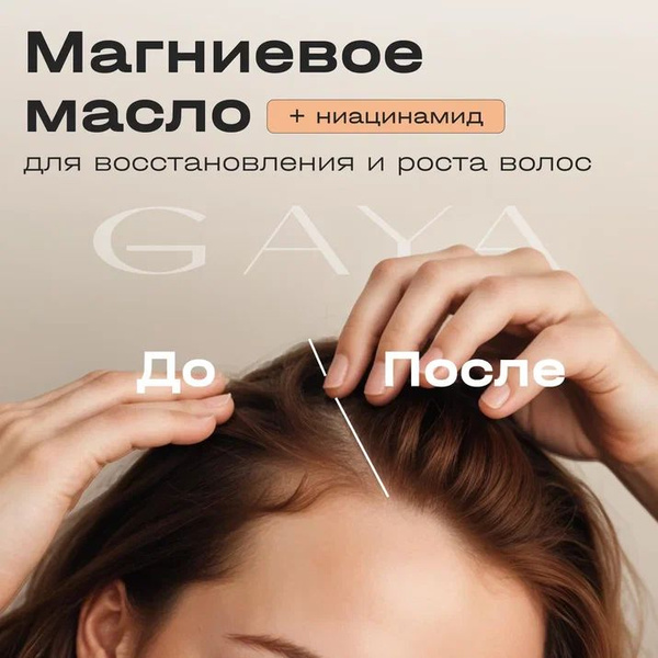 Magnesium Oil for Hair Growth & Repair with Niacin (200ml)