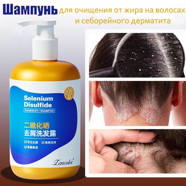 Horsepower Anti-Dandruff Shampoo for Itch, Psoriasis & Seborrhea (300ml)