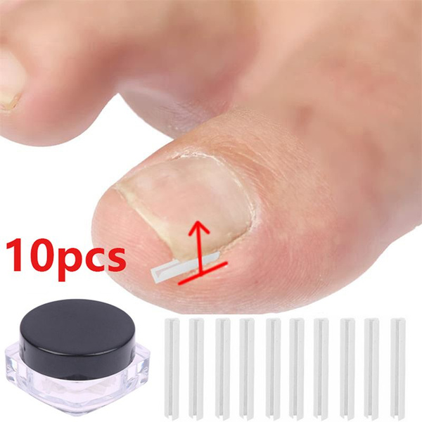 Nail Filling Overlay