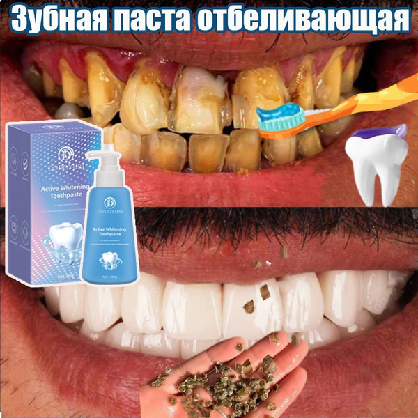 Whitening Toothpaste with Dispenser: Strengthens Gums, Prevents Cavities, Mint (280ml)