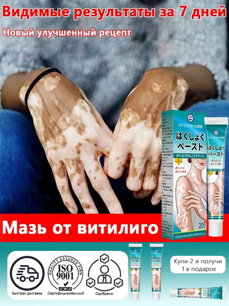 Vitiligo Cream: Effective Treatment for White Spots (20g)