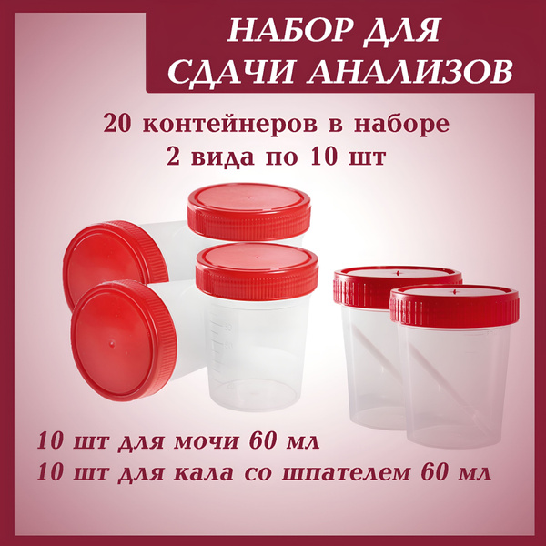 Urine & Stool Sample Containers (20 Pack)