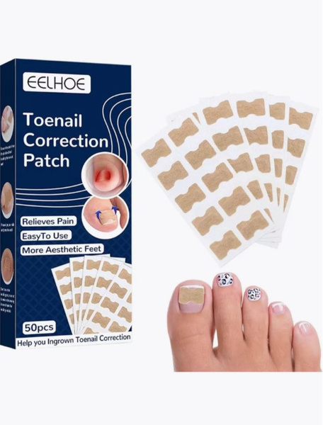 Ingrown Toenail Patches: Corrective Adhesive Strips