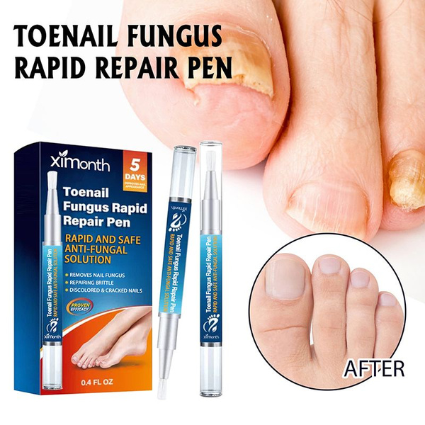 Nail Repair Pen