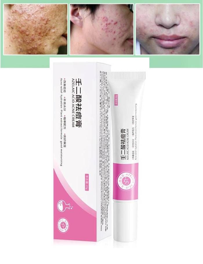 Dimollaure Salicylic Acid Acne Cream 20 ml