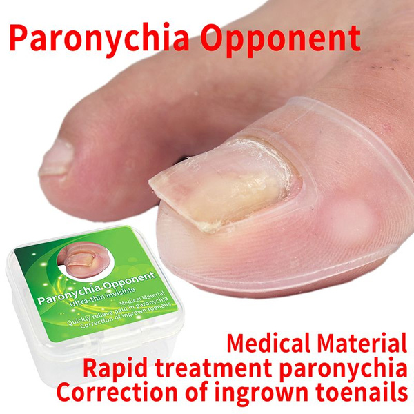 Invisible Nail Corrector Device