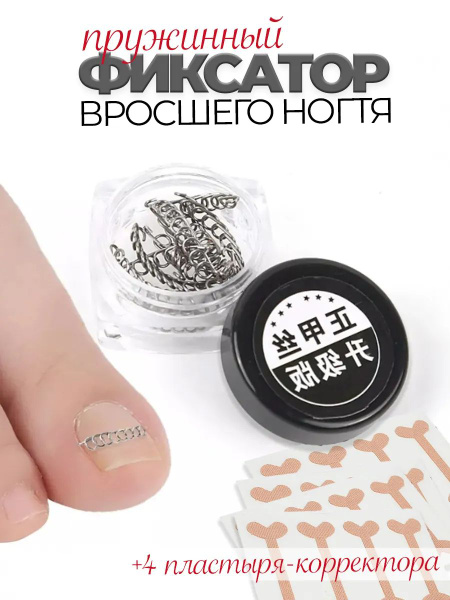 Ingrown Toenail Brace Corrector