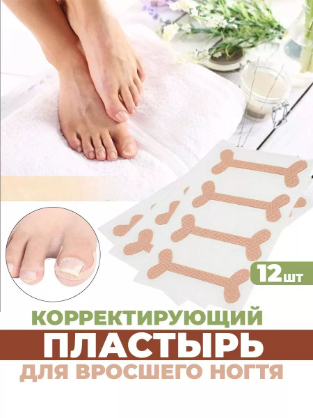 Ingrown Toenail Corrector Patch