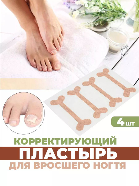 Ingrown Toenail Corrector Patch