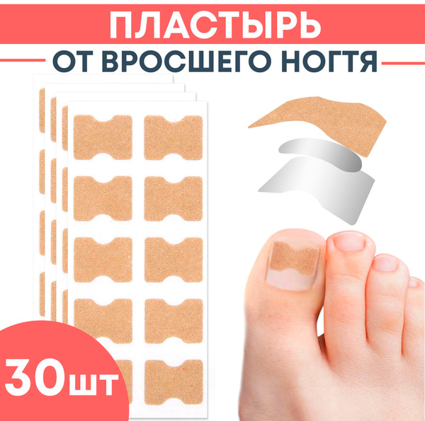 Ingrown Toenail Corrector Patch