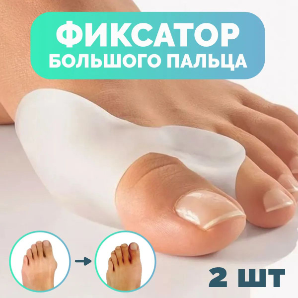 2 Silicone Toe Separators: Bunion Corrector & Big Toe Fixator