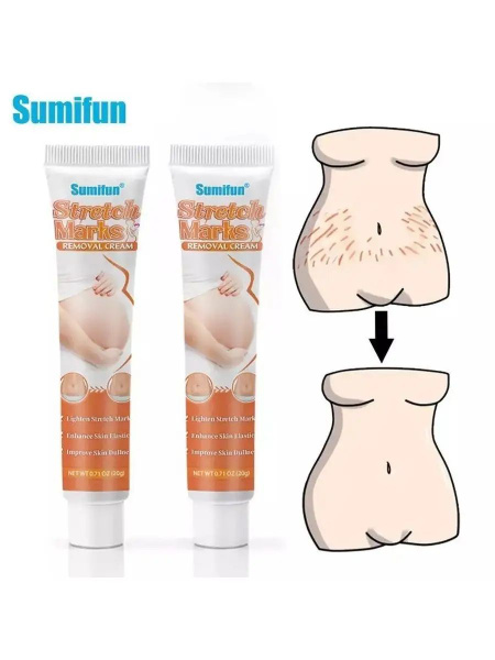 Hydrating Chinese Stretch Mark Cream