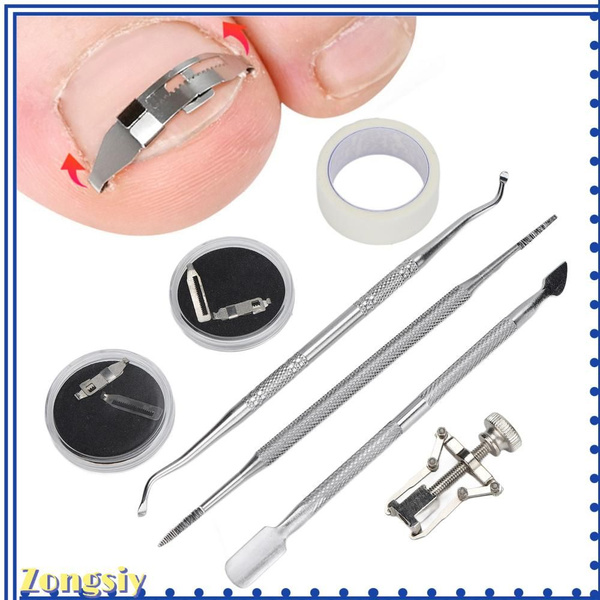 Ingrown Toenail Treatment Tools
