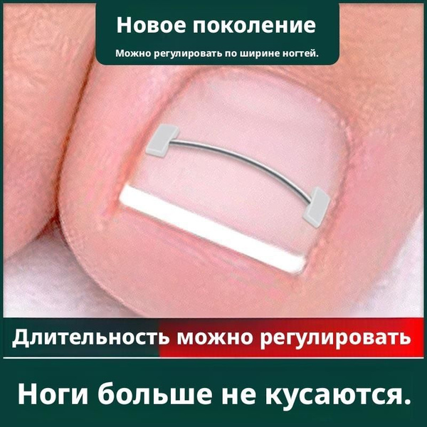 Ingrown Toenail Correction Patches with Metal Insert