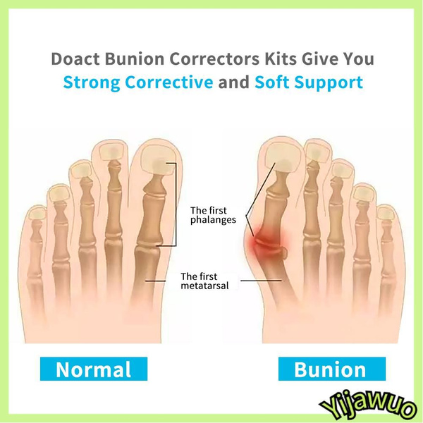 Bursitis Treatment & Relief
