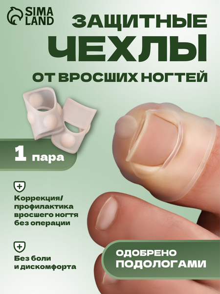 Silicone Nail Covers for Ingrown Toenail Correction & Protection