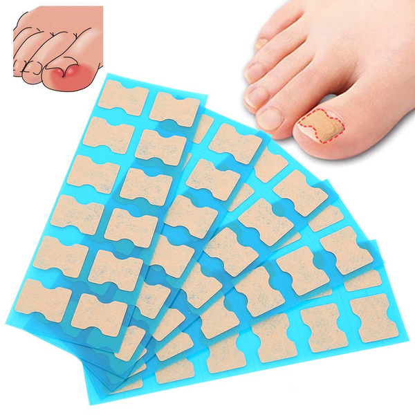 Adhesive-Free Orthopedic Nail Stickers