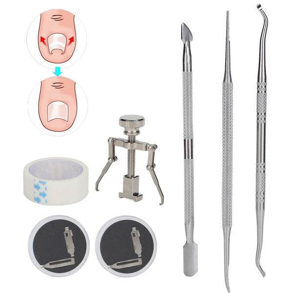 Ingrown Toenail Tools & Treatment