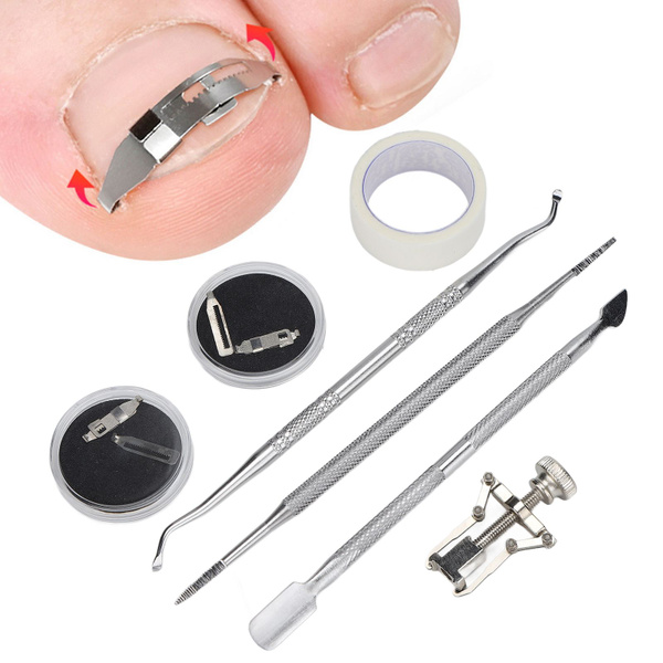Ingrown Toenail Tools & Solutions